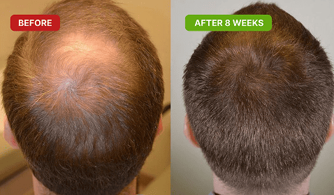 Akemi hair glow customer-John N.